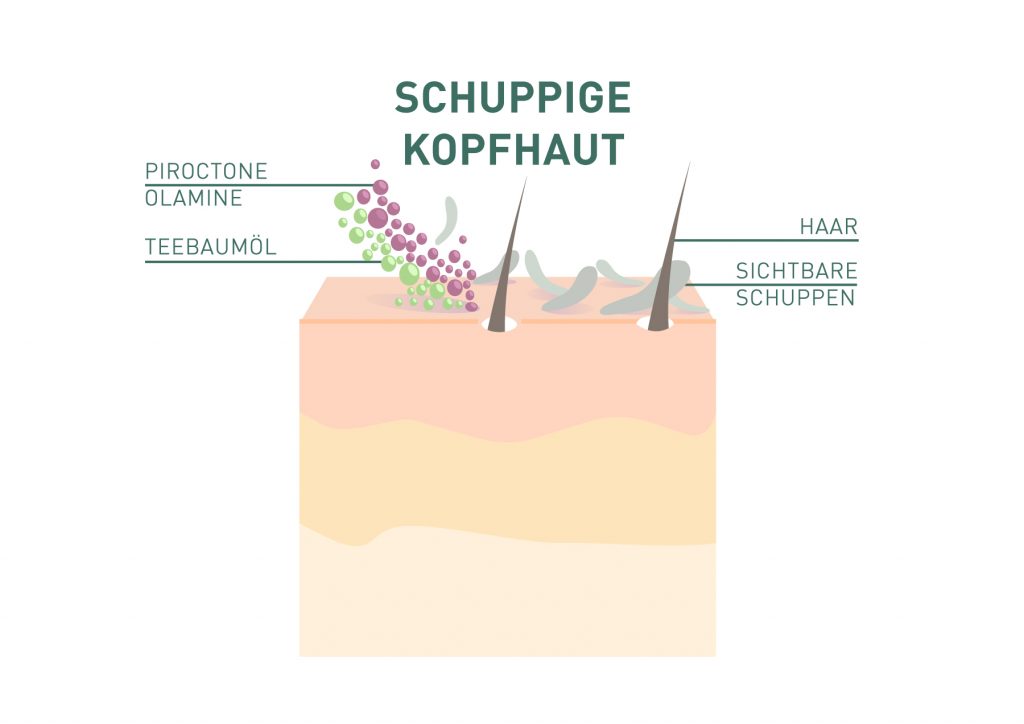 Infografik Wirkung von Teebaumöl und Piroctone Olamine auf Schuppen und die Kopfhaut