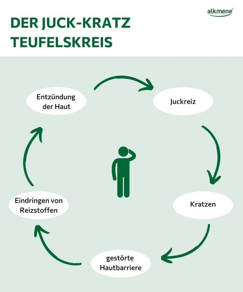 Wieso kribbelnde Kopfhaut? Infografik zu Ursachen von Kribbeln auf der Kopfhaut