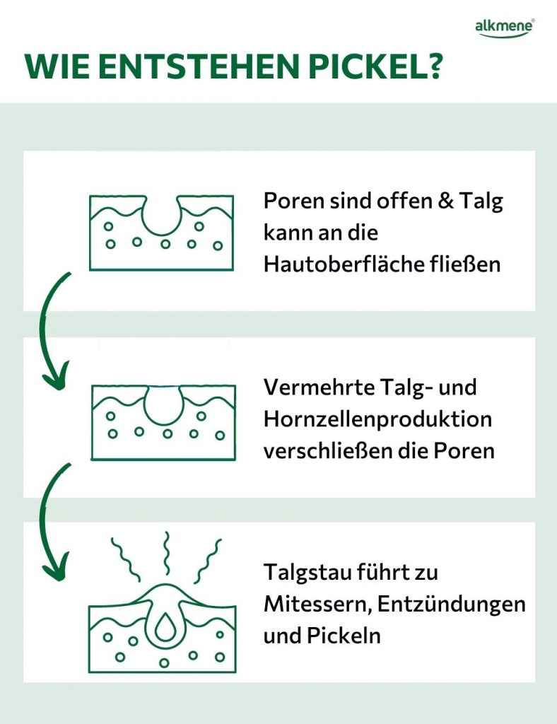 Wie entstehen Pickel Infografik
