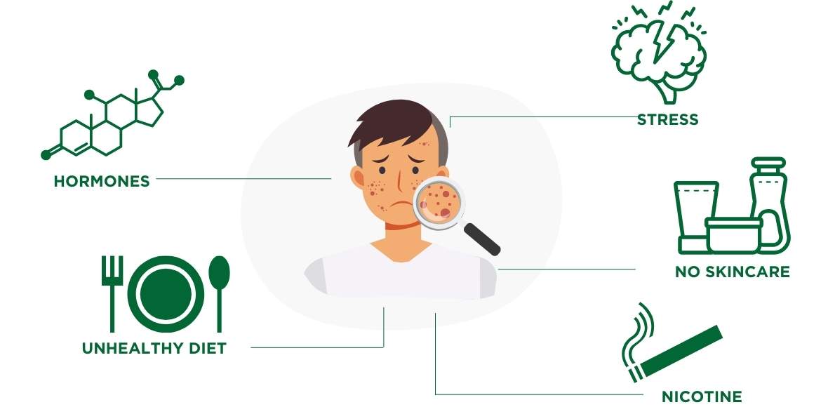 Causes of blemished skin