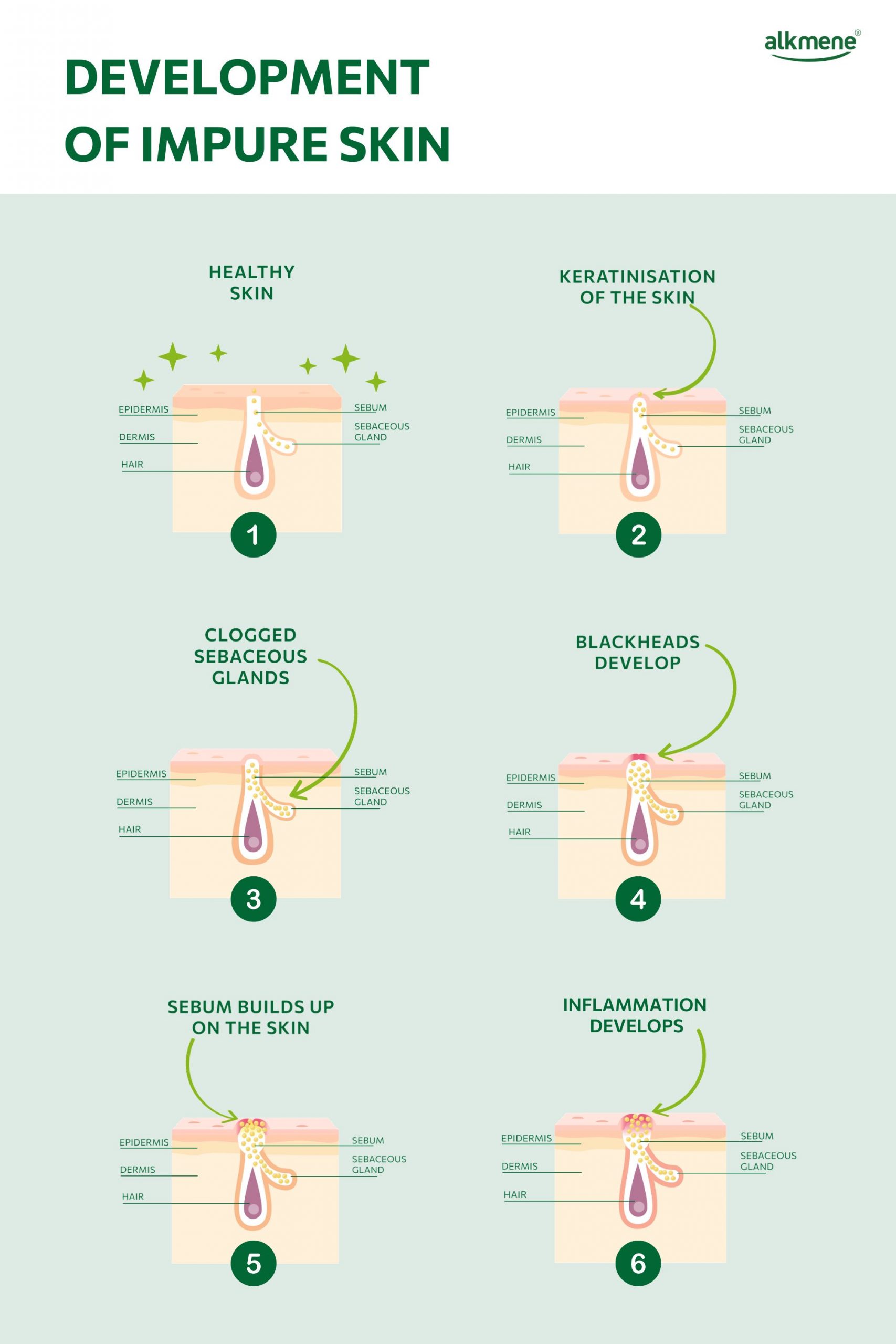 Development of impure skin
