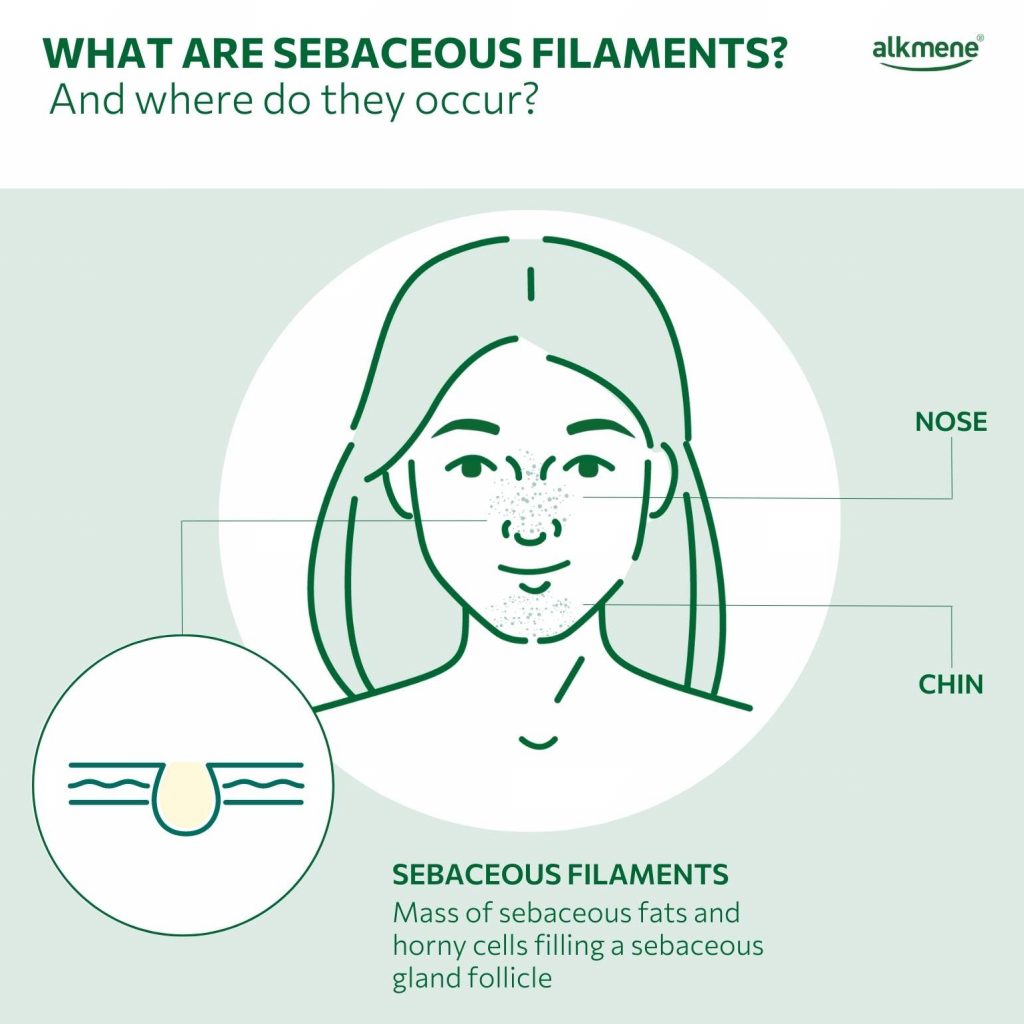 infografic on sebaceous filaments and where they occur