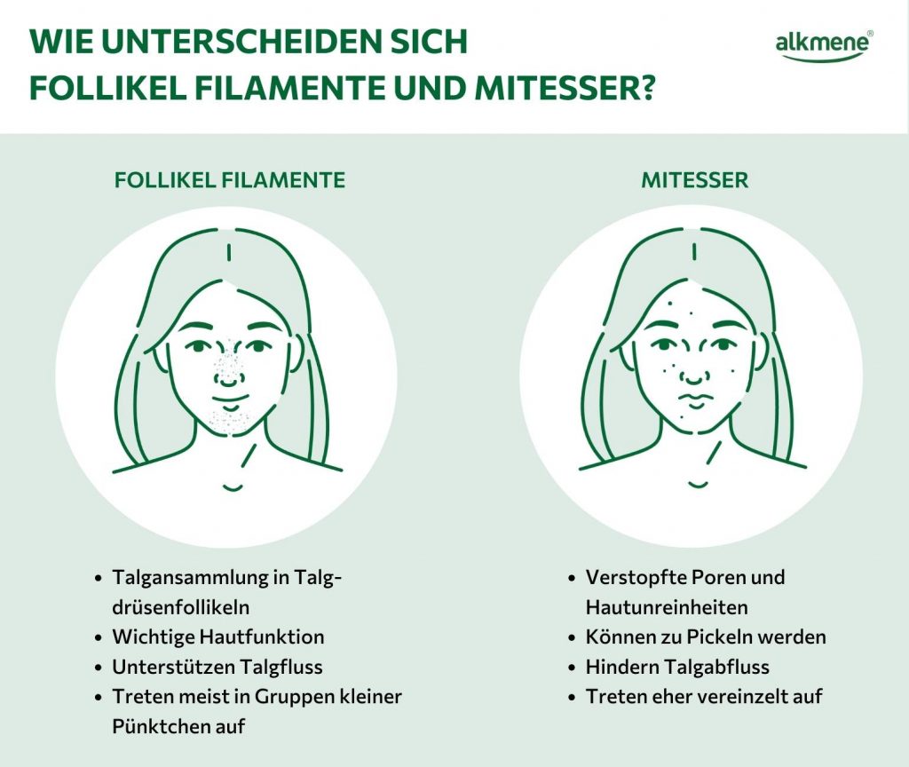 infografik zum unterschied von follikel filamenten und mitessern