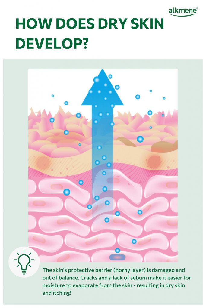 Infografic on how itchy legs develop