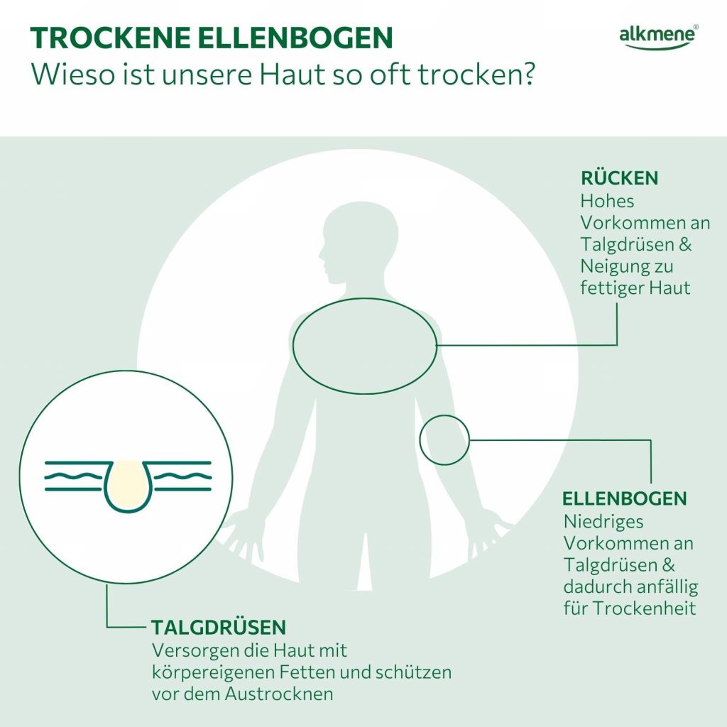 Infografik zur Entstehung von trockenen Ellebogen
